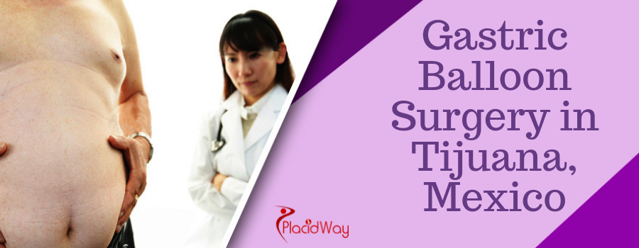 Gastric Balloon Surgery in Tijuana, Mexico Gastric Balloon Surgery in Tijuana, Mexico